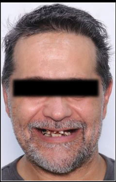 Prima del Trattamento 2