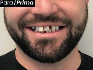 Prima del Trattamento 3