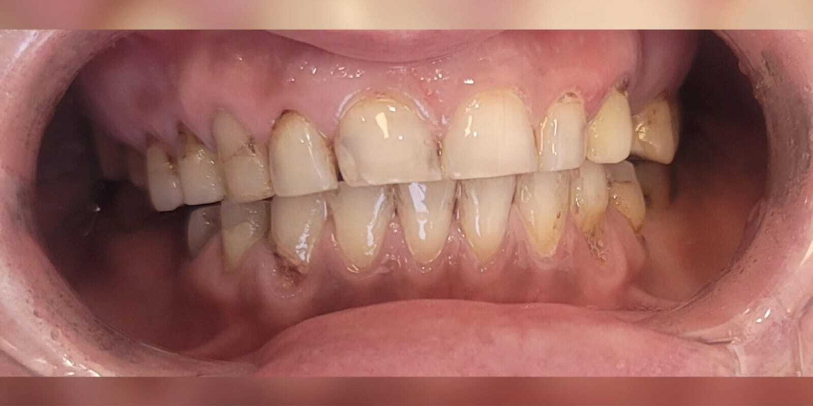 Prima del Trattamento 4