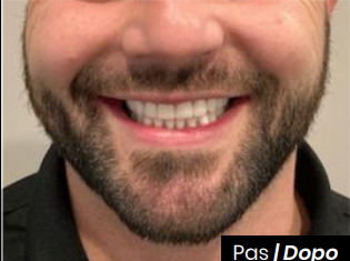 Dopo il Trattamento 3